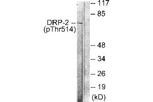 Immunohistochemistry analysis of paraffin-embedded human brain tissue using DRP-2 (Phospho-Thr514) antibody. (DRP2 antibody  (pThr514))