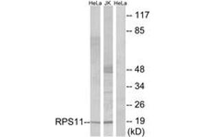 Western blot analysis of extracts from HeLa/Jurkat cells, using RPS11 Antibody. (RPS11 antibody  (AA 71-120))