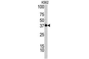 Image no. 1 for anti-Complement Factor H-Related 1 (CFHR1) (C-Term) antibody (ABIN452839) (CFHR1 antibody  (C-Term))
