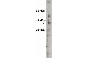 Western blot analysis using Ceramide Glycosyltransferase antibody (X1700P) on 7 ug  of rat kidney lysate.