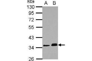 WB Image Sample (30 ug of whole cell lysate) A: A431 B: HeLa 10% SDS PAGE antibody diluted at 1:1000