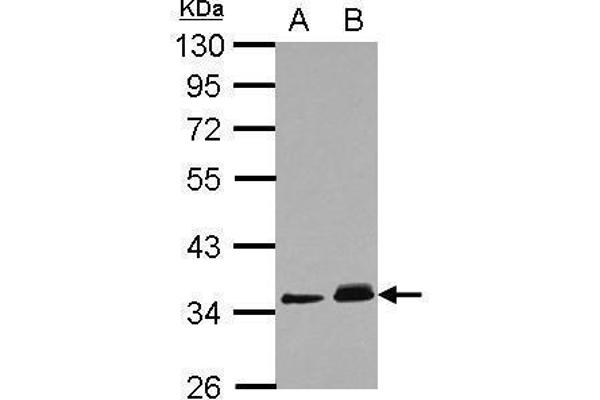 PPM1J Antikörper