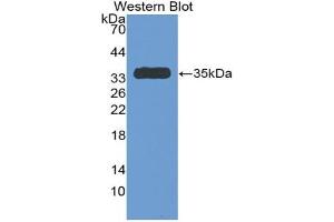 Western blot analysis of the recombinant protein. (SERPINC1 antibody  (AA 150-426))