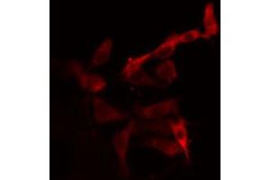 ABIN6266992 staining 293 cells by IF/ICC. (CYP2C19 antibody  (C-Term))