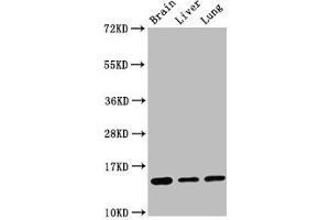 Western Blot Positive WB detected in: Mouse brain tissue, Rat liver tissue, Rat lung tissue All lanes: Histone H2B type 1-K antibody at 0. (Recombinant HIST1H2BK antibody)