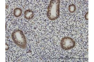 Image no. 2 for anti-AF4/FMR2 Family, Member 4 (AFF4) (AA 1-109) antibody (ABIN466197) (AFF4 antibody  (AA 1-109))