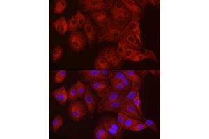 Immunofluorescence analysis of A-549 cells using WISP2 Rabbit pAb (ABIN6128928, ABIN6150226, ABIN6150228 and ABIN6216206) at dilution of 1:100 (40x lens). (WISP2 antibody  (AA 151-250))