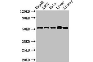 Western Blot Positive WB detected in: HepG2 whole cell lysate, K562 whole cell lysate, Hela whole cell lysate, Mouse liver tissue, Mouse kidney tissue All lanes: FBXW2 antibody at 3 μg/mL Secondary Goat polyclonal to rabbit IgG at 1/50000 dilution Predicted band size: 52, 45 kDa Observed band size: 52 kDa (FBXW2 antibody  (AA 72-340))