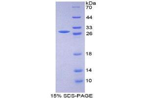 SDS-PAGE (SDS) image for CD33 (CD33) (AA 18-240) protein (His tag,T7 tag) (ABIN2126747)