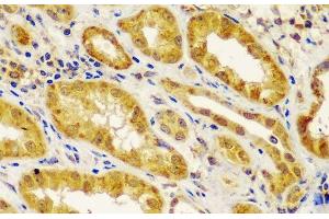 Immunohistochemistry of paraffin-embedded Human kidney using MT1-MMP Polyclonal Antibody at dilution of 1:100 (40x lens). (MMP14 antibody)