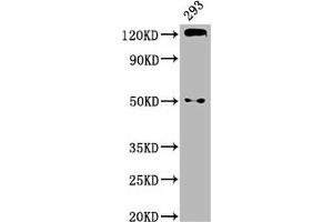 Western Blot Positive WB detected in: 293 whole cell lysate All lanes: CDH1 antibody at 2.