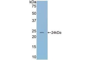 Detection of Recombinant CBG, Mouse using Polyclonal Antibody to Corticosteroid Binding Globulin (CBG) (SERPINA6 antibody  (AA 57-256))