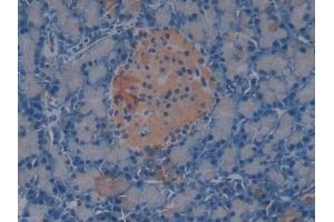 Immunohistochemistry (IHC) image for anti-Anti-Mullerian Hormone (AMH) (AA 447-553) antibody (ABIN7431407)