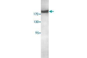Western blot analysis of HeLa cell lysate with RICTOR polyclonal antibody  at 1 : 500 dilution. (RICTOR antibody  (AA 1406-1700))