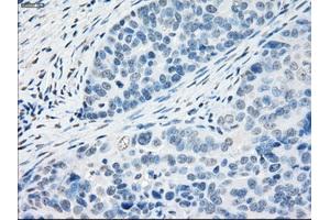 Immunohistochemical staining of paraffin-embedded Kidney tissue using anti-PPP5Cmouse monoclonal antibody. (PP5 antibody)