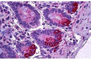 Human Intestine, Paneth Cells: Formalin-Fixed, Paraffin-Embedded (FFPE) (IL12A antibody)