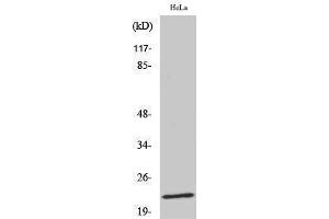 Western Blotting (WB) image for anti-Caveolin 1, Caveolae Protein, 22kDa (CAV1) (pTyr14) antibody (ABIN3181949) (Caveolin-1 antibody  (pTyr14))