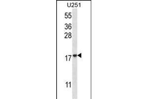 EIF1AY Antibody (N-term) (ABIN657081 and ABIN2846242) western blot analysis in  cell line lysates (35 μg/lane). (EIF1AY antibody  (N-Term))