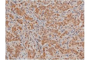 Immunohistochemistry (IHC) image for anti-Filamin A, alpha (FLNA) (pSer2152) antibody (ABIN6256196)