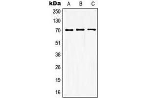 Western blot analysis of GUCY1B3 expression in HEK293T (A), mouse kidney (B), rat kidney (C) whole cell lysates. (GUCY1B3 antibody  (N-Term))