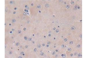 Detection of TXNIP in Mouse Brain Tissue using Polyclonal Antibody to Thioredoxin-interacting Protein (TXNIP) (TXNIP antibody  (AA 30-381))