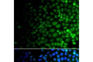 Immunofluorescence analysis of A549 cells using ULK4 Polyclonal Antibody (ULK4 antibody)