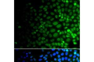Immunofluorescence analysis of A549 cells using ULK4 Polyclonal Antibody