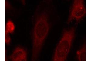 Immunofluorescence staining of methanol-fixed Hela cells using Phospho-EIF2S1-S51 antibody. (EIF2S1 antibody  (pSer51))