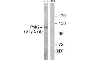Western Blotting (WB) image for anti-PTK2B Protein tyrosine Kinase 2 beta (PTK2B) (pTyr579) antibody (ABIN1847713) (PTK2B antibody  (pTyr579))