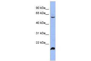 WB Suggested Anti-SFRS4 Antibody Titration:  0. (SRSF4 antibody  (Middle Region))
