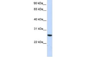 TTC33 antibody used at 1 ug/ml to detect target protein. (TTC33 antibody  (N-Term))