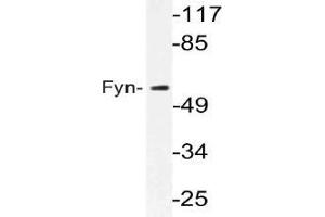 Western blot (WB) analysis of Fyn antibody in extracts from MCF-7 cells.