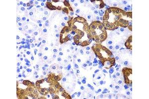 Immunohistochemistry of paraffin-embedded Rat kidney using KRT19 Polyclonal Antibody at dilution of 1:100 (40x lens). (Cytokeratin 19 antibody)