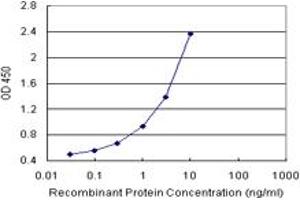 SERPINB1 (Human) Matched Antibody Pair