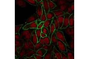 Immunofluorescence (IF) image for anti-Catenin (Cadherin-Associated Protein), beta 1, 88kDa (CTNNB1) antibody (ABIN6939202)