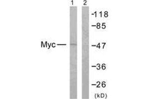 Western blot analysis of extracts from NIH-3T3 cells, treated with EGF 200ng/ml 30', using MYC (Ab-358) Antibody. (c-MYC antibody  (AA 325-374))