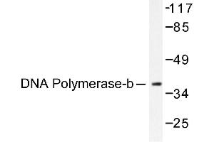 Image no. 1 for anti-Polymerase (DNA Directed), beta (POLB) antibody (ABIN265385) (POLB antibody)