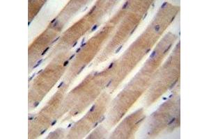 RHEB antibody immunohistochemistry analysis in formalin fixed and paraffin embedded human skeletal muscle. (RHEB antibody  (AA 104-134))