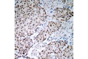 Immunohistochemistry (IHC) image for anti-Tumor Protein P53 (TP53) (pSer315) antibody (ABIN3020520) (p53 antibody  (pSer315))