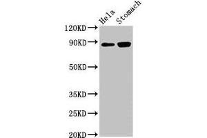 Western Blot Positive WB detected in: Hela whole cell lysate, Rat stomach tissue All lanes: ASAH2 antibody at 3 μg/mL Secondary Goat polyclonal to rabbit IgG at 1/50000 dilution Predicted band size: 86, 82 kDa Observed band size: 86 kDa (ASAH2 antibody  (AA 255-506))