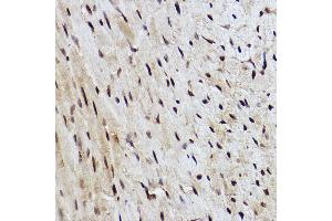 Immunohistochemistry of paraffin-embedded mouse heart using R Rabbit mAb (ABIN7269844) at dilution of 1:100 (40x lens). (RanBP3 antibody)
