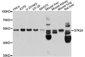Western blot analysis of extracts of various cell lines, using STK24 antibody. (STK24 antibody)