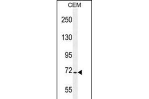 STIM1 Antibody (C-term) (ABIN654073 and ABIN2843969) western blot analysis in CEM cell line lysates (35 μg/lane). (STIM1 antibody  (C-Term))