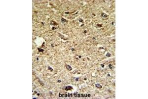 Immunohistochemistry (IHC) image for anti-CCR4 Carbon Catabolite Repression 4-Like (CCRN4L) antibody (ABIN3002711) (CCRN4L antibody)