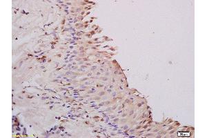 Formalin-fixed and paraffin embedded rat ovary tissue labeled with Anti A1BG Polyclonal Antibody,Unconjugated (ABIN872952) at 1:200 followed by conjugation to the secondary antibody and DAB staining.