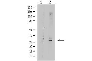 Western blot analysis of extracts from rat muscle, using TNFRSF10C  Antibody.
