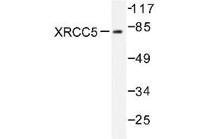 Image no. 1 for anti-X-Ray Repair Complementing Defective Repair in Chinese Hamster Cells 5 (Double-Strand-Break Rejoining) (XRCC5) antibody (ABIN271983) (XRCC5 antibody)