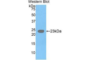 Western blot analysis of the recombinant protein. (GDF3 antibody  (AA 251-364))