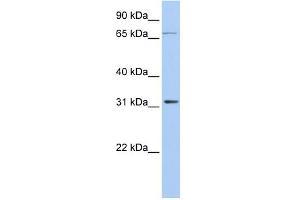 WB Suggested Anti-IDI1 Antibody Titration: 0. (IDI1 antibody  (Middle Region))