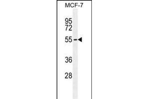PCA Antibody (C-term) (ABIN655112 and ABIN2844743) western blot analysis in MCF-7 cell line lysates (35 μg/lane). (PMPCA antibody  (C-Term))
